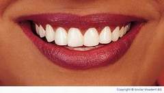 natürlich weiße Zähne